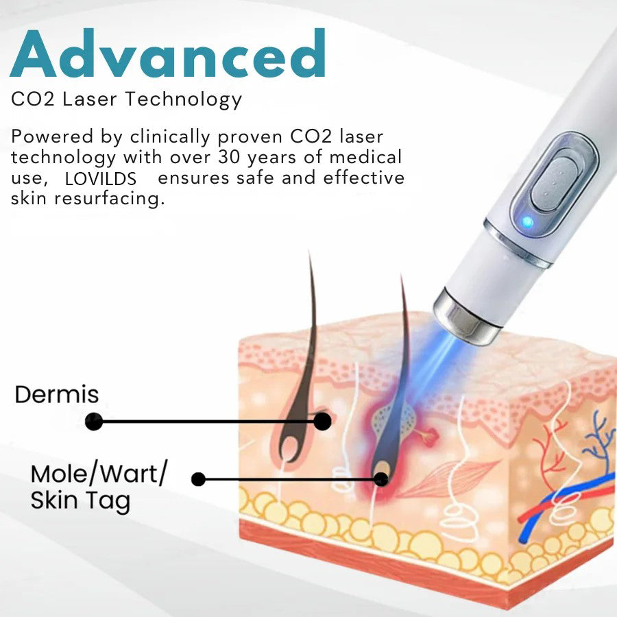 Removal Laser Pen